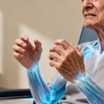 Dystonie musculaire chez la personne âgée : reconnaître et traiter sans aucun texte